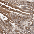 Immunohistochemical staining of human small intestine shows moderate to strong cytoplasmic positivity in lymphoid cells.