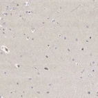 Immunohistochemical staining of human cerebral cortex shows no positivity in neurons as expected.