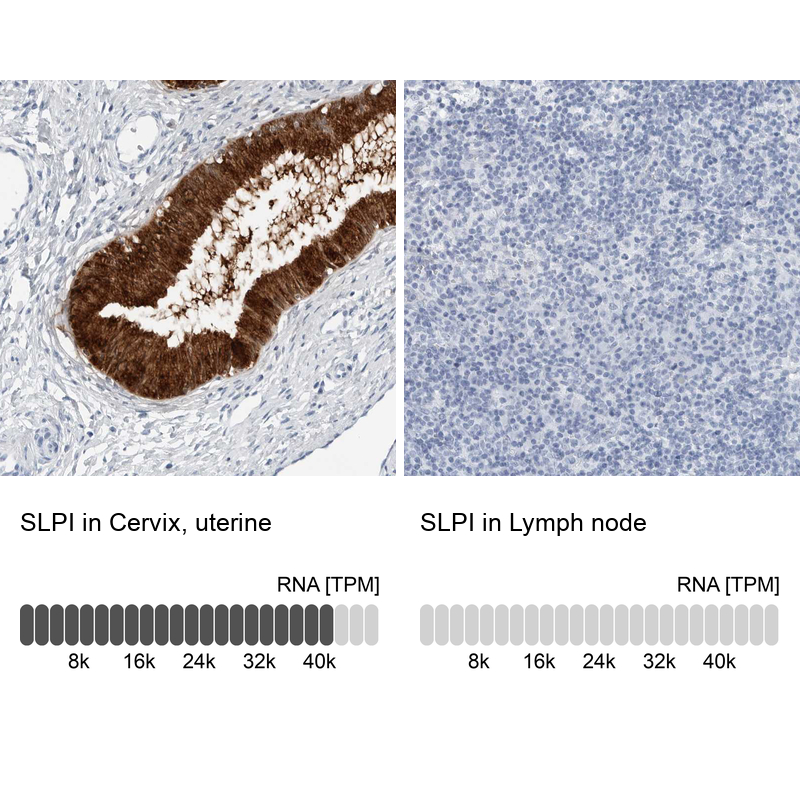 Anti-SLPI Antibody