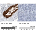 Anti-SLPI Antibody