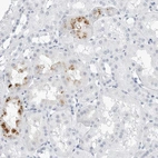 Immunohistochemical staining of human kidney shows moderate cytoplasmic positivity in cells in tubules.