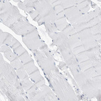 Immunohistochemical staining of human skeletal muscle shows negative cytoplasmic positivity in myocytes as expected.