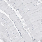 Immunohistochemical staining of human skeletal muscle shows negative cytoplasmic positivity in myocytes as expected.