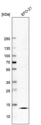 Western blot analysis in human cell line EFO-21.