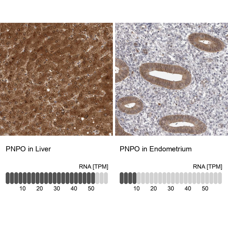 Anti-PNPO Antibody