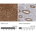 Anti-PNPO Antibody