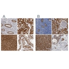 Immunohistochemical staining of human endometrium, kidney, liver and testis using Anti-PNPO antibody HPA027776 (A) shows similar protein distribution across tissues to independent antibody HPA023204 (B).