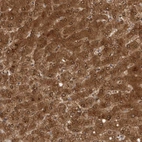 Immunohistochemical staining of human liver shows strong cytoplasmic positivity in hepatocytes.