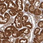 Immunohistochemical staining of human kidney shows strong cytoplasmic positivity in cells in tubules.