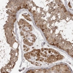 Immunohistochemical staining of human testis shows moderate cytoplasmic-nuclear positivity in Leydig cells and cells in seminiferous ducts.