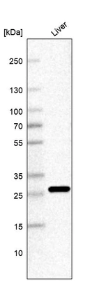 Western blot analysis in human liver tissue.