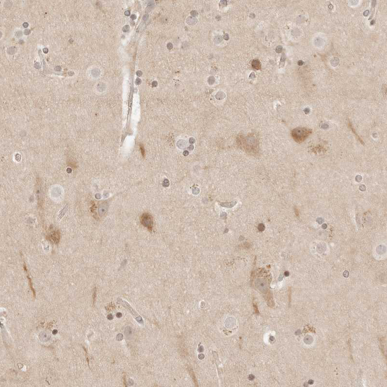 Anti-RPS6KL1 Antibody