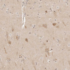 Anti-RPS6KL1 Antibody