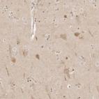 Anti-RPS6KL1 Antibody