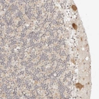Immunohistochemical staining of human cerebellum shows strong cytoplasmic positivity in Purkinje cells.