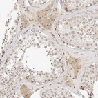 Immunohistochemical staining of human testis shows moderate cytoplasmic positivity in Leydig cells.