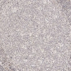 Immunohistochemical staining of human tonsil shows no positivity in germinal center cells as expected.