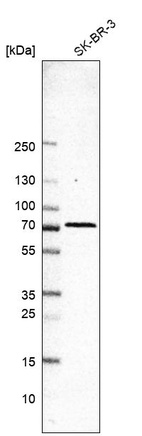 Western blot analysis in human cell line SK-BR-3.