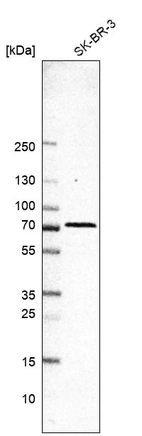 Western blot analysis in human cell line SK-BR-3.
