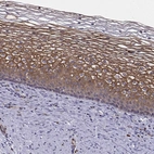 Immunohistochemical staining of human cervix, uterine shows strong membranous positivity in squamous epithelial cells.