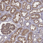 Immunohistochemical staining of human kidney shows strong membranous positivity in cells in tubules.