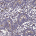 Anti-ITGB8 Antibody