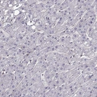 Immunohistochemical staining of human liver shows no positivity in hepatocytes as expected.