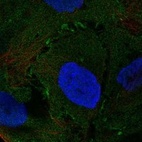 Anti-NMUR2 Antibody