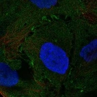 Anti-NMUR2 Antibody