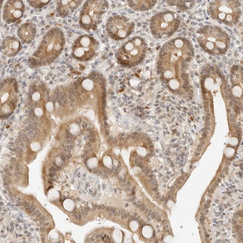 Anti-NEO1 Antibody