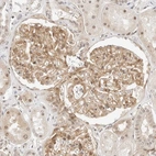 Immunohistochemical staining of human kidney shows moderate membranous positivity in cells in glomeruli.