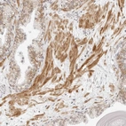 Immunohistochemical staining of human prostate shows moderate cytoplasmic positivity in smooth muscle cells.