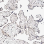 Immunohistochemical staining of human placenta shows no positivity in trophoblastic cells as expected.