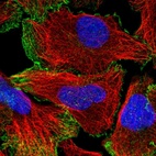 Immunofluorescent staining of human cell line U-2 OS shows localization to nucleoplasm & plasma membrane.