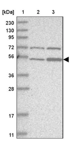 Lane 1: Marker [kDa] 230, 130, 95, 72, 56, 36, 28, 17, 11_br/_Lane 2: Human cell line RT-4_br/_Lane 3: Human cell line U-251MG sp