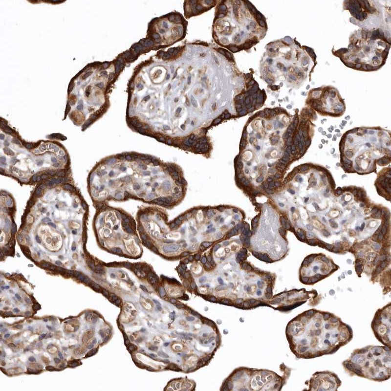 Anti-FAM212B Antibody