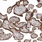 Anti-FAM212B Antibody