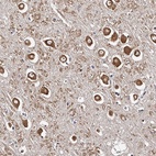Anti-RSC1A1 Antibody