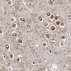 Anti-RSC1A1 Antibody