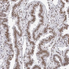 Immunohistochemical staining of human Fallopian tube shows moderate nuclear positivity in glandular cells.