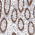 Immunohistochemical staining of human colon shows strong nuclear positivity in glandular cells.