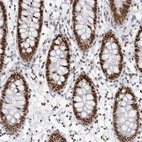Immunohistochemical staining of human colon shows strong nuclear positivity in glandular cells.