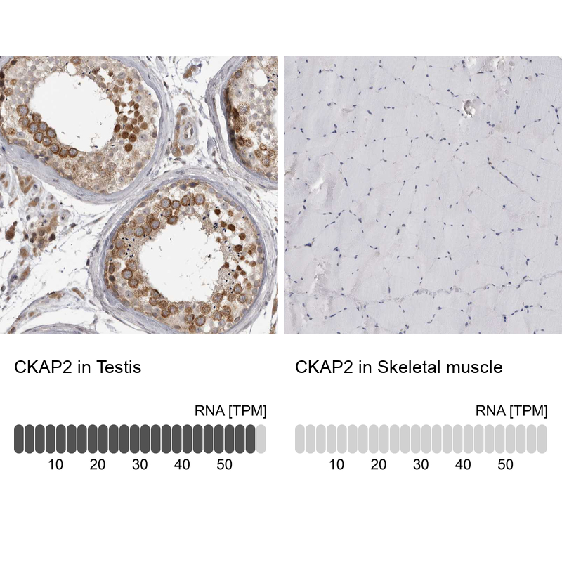 Anti-CKAP2 Antibody
