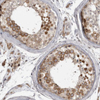 Immunohistochemical staining of human testis shows moderate positivity.