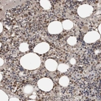 Immunohistochemical staining of human bone marrow shows moderate cytoplasmic positivity in hematopoietic cells.