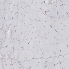 Immunohistochemical staining of human skeletal muscle shows no positivity in myocytes as expected.
