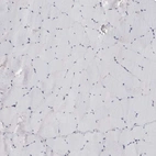 Immunohistochemical staining of human skeletal muscle shows no positivity in myocytes as expected.