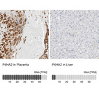 Anti-P4HA2 Antibody