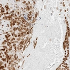 Immunohistochemical staining of human placenta shows strong cytoplasmic positivity in decidual cells.