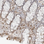 Immunohistochemical staining of human rectum shows strong cytoplasmic positivity in glandular cells.